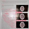 Poster Sessions