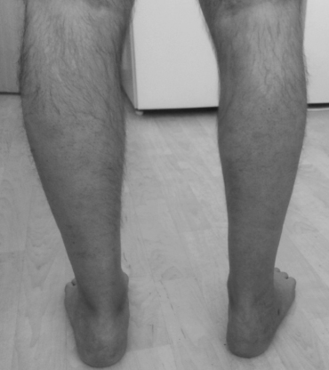 fig1