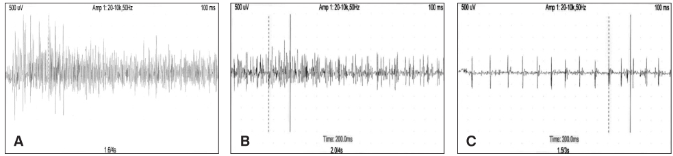 fig2