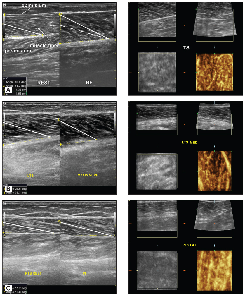 fig3