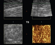 fig3.small